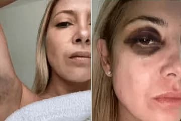 Before and After Meme — Before After meme