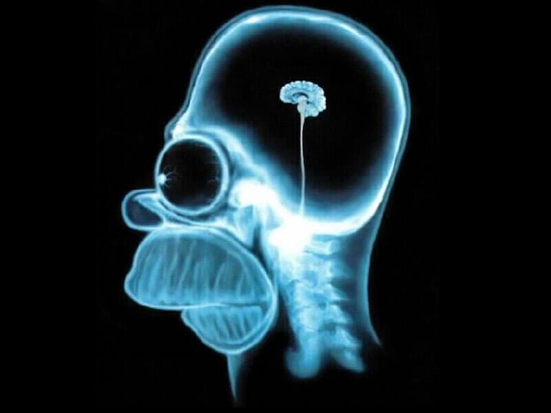 Homer Simpson X-Ray Reveals Tiny Brain — Simpsons meme